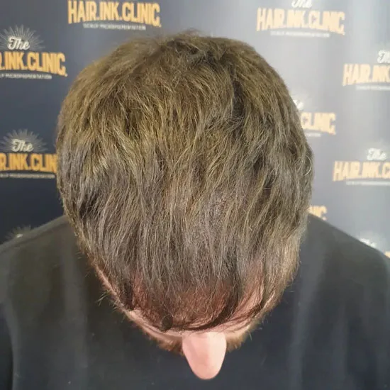 7 Haircuts for Balding Crown  Hide Bald Spots within Minutes  Haircuts  for balding men Haircuts for balding crown Balding mens hairstyles